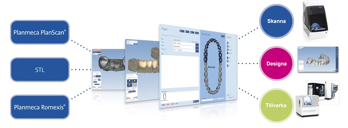 digitala-avtryck-cad-cam-labb.jpg